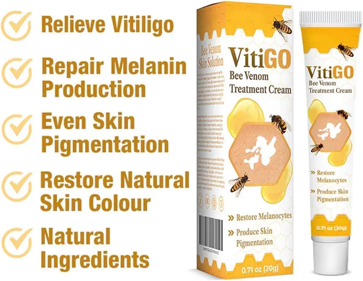 Vitigo Cream Bee Venom Treatment Cream For Skin and Rashes